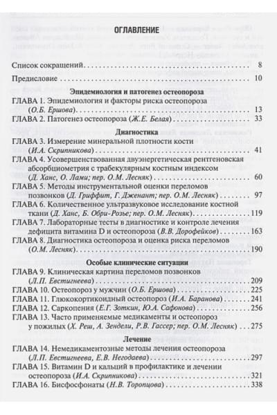 Лесняк О. (ред.): Остеопороз. Руководство для врачей