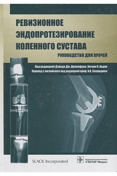Джакофски Д., Хэдли Э. (ред.): Ревизионное эндопротезирование коленного сустава. Руководство для врачей