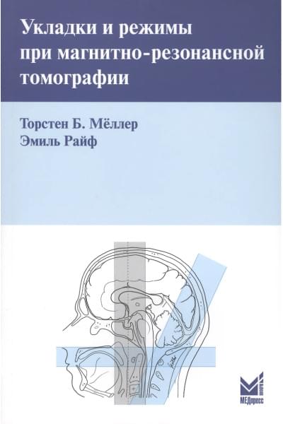 Меллер Торстен Б.: Укладки и режимы при магнитно-резонансной томографии.