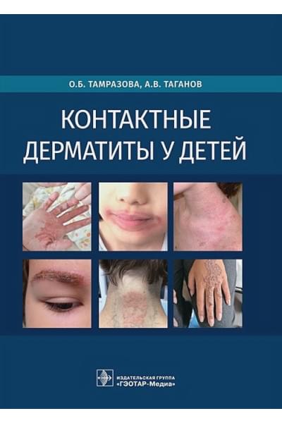 Тамразова О., Таганов А.: Контактные дерматиты у детей