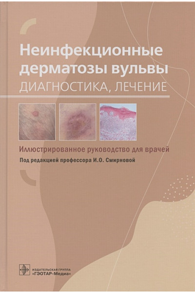 Смирнова И. (ред.): Неинфекционные дерматозы вульвы: диагностика, лечение. Иллюстрированное руководство для врачей
