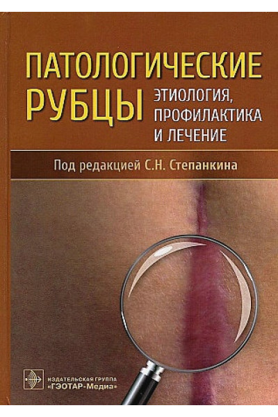 Степанкин С.Н.: Патологические рубцы. Этиология, профилактика и лечение
