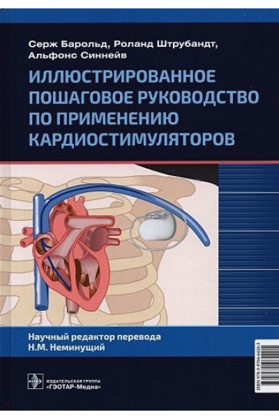 Барольд С.,Штрубандт С.,Синнейв А: Иллюстрированное пошаговое руководство по применению кардиостимуляторов