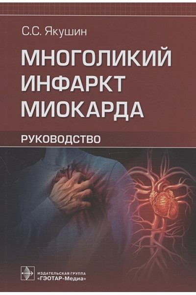 Якушин С.: Многоликий инфаркт миокарда: руководство