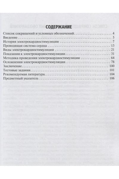 Калинин Р., Сучков И., Мжаванадзе Н. и др.: Основы электрокардиостимуляции
