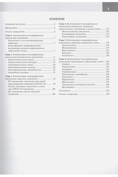 Аджиева З., Басек И., Бенкен А. и др.: Компьютерная томография в диагностике пневмоний. Атлас. Руководство для врачей