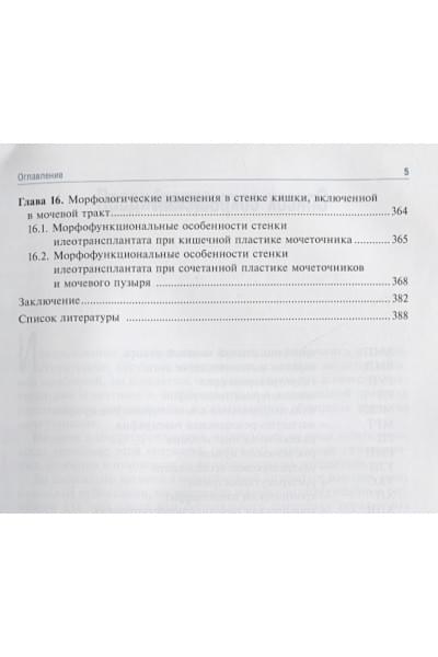 Комяков Б.: Кишечная и аппендикулярная пластика мочеточников