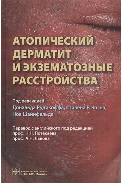 Рудикофф Д., Коэн С., Шайнфельд Н. (ред.): Атопический дерматит и экзематорные расстройства