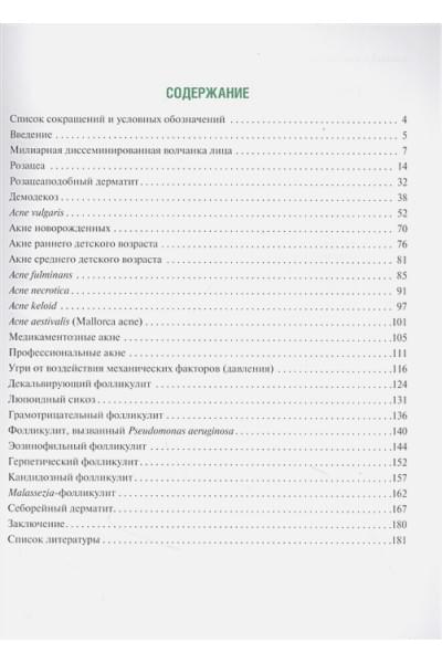 Раводин Р., Разнатовский К.: Акнеформные дерматозы и акне в практике врача-дерматовенеролога: руководство для врачей