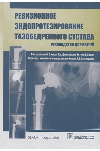 Джакофски Д., Хэдли Э. (ред.): Ревизионное эндопротезирование тазобедренного сустава. Руководство для врачей
