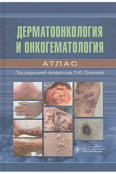 Олисова О. (ред.): Дерматоонкология и онкогематология. Атлас