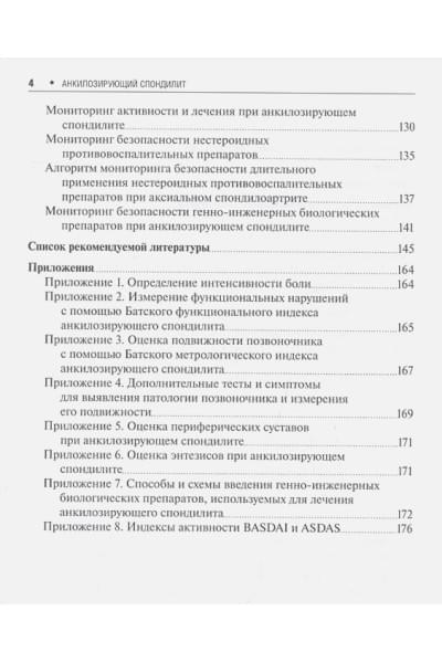 Эрдес Ш.: Анкилозирующий спондилит