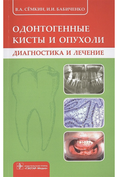 Семкин В., Бабиченко И.: Одонтогенные кисты и опухоли. Диагностика и лечение