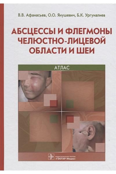 Афанасьев В., Янушевич О., Ургуналиев Б.: Абсцессы и флегмоны челюстно-лицевой области и шеи. Атлас