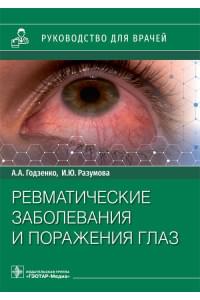 Ревматические заболевания и поражения глаз. Руководство