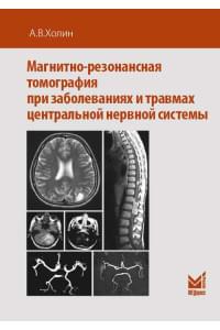 Магнитно-резонансная томография при заболеваниях и травмах центральной нервной системы