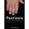 Psoriasis. Diagnosis and Management
