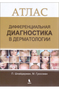 Дифференциальная диагностика в дерматологии