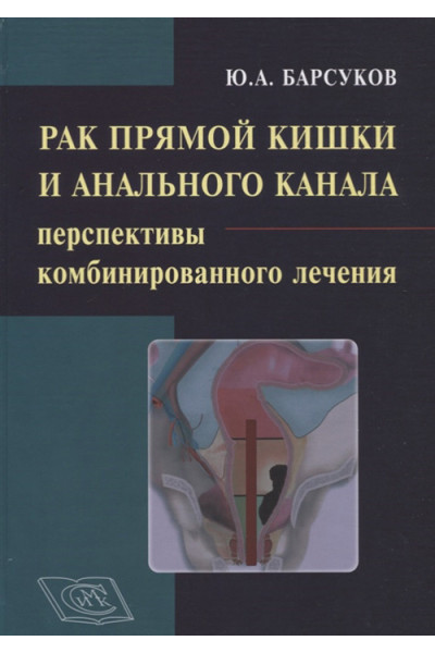 Рак прямой кишки и анального канала. Перспективы комбинированного лечения. Руководство