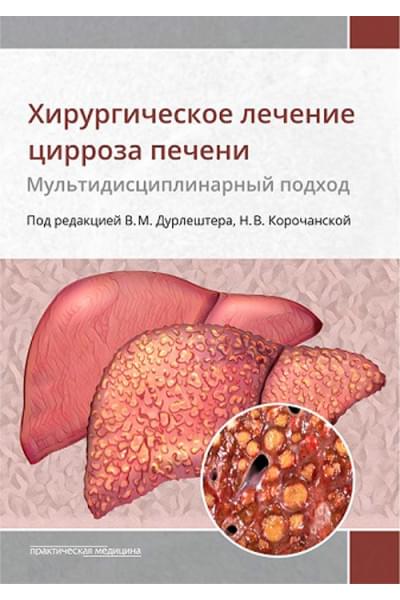 Хирургическое лечение цирроза печени: мультидисциплинарный подход