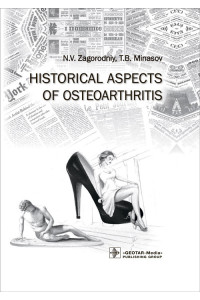 Historical aspects of osteoarthritis