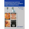 Эндоскопическая хирургия околоносовых пазух и переднего отдела основания черепа