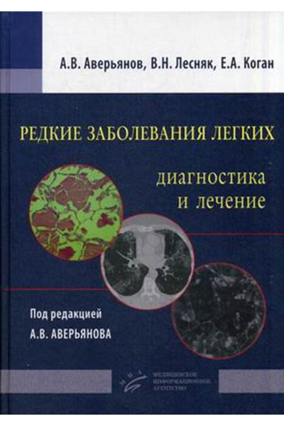 Редкие заболевания легких: диагностика и лечение