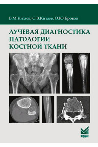 Лучевая диагностика патологии костной ткани