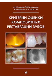 Критерии оценки композитных реставраций зубов