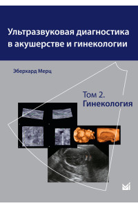 Ультразвуковая диагностика в акушерстве и гинекологии в 2-х томах. Том 2. Гинекология
